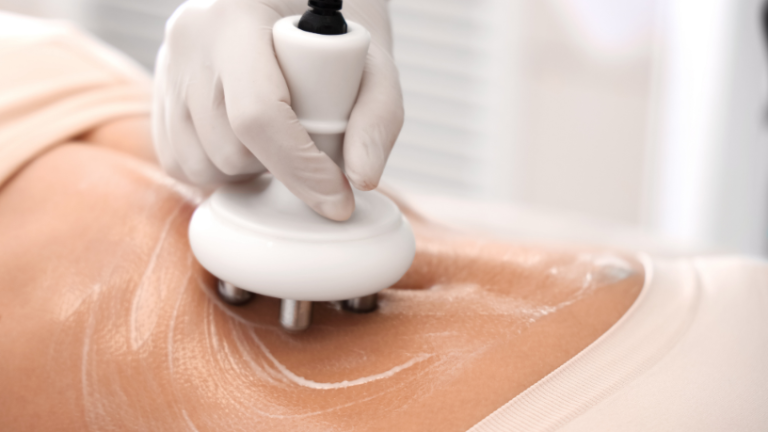 Tecnologias estéticas em alta: como escolher tratamentos sem colocar o corpo em risco Tecnologias estéticas em alta: como escolher tratamentos sem colocar o corpo em risco