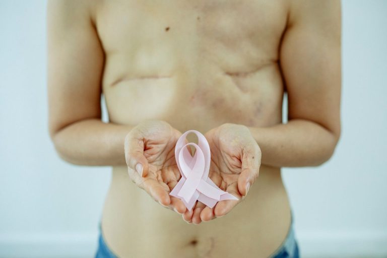 Mulher com o torso parcialmente exposto e cicatriz de cirurgia na mama, segurando uma fita rosa em um estúdio claro.